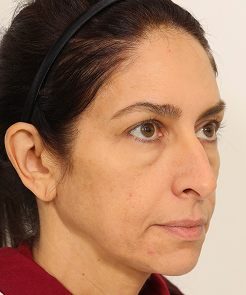 Lattman-Gallery Scroll11