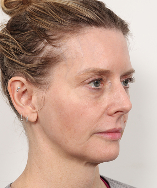 Lattman-Gallery Scroll3