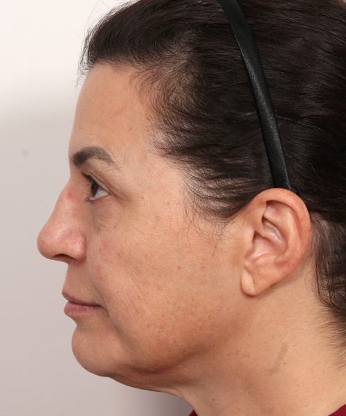 Lattman-Gallery Scroll9