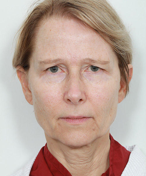 Lattman-Homepage-Results1