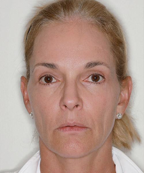 Lattman-Homepage-Results4