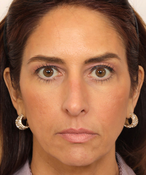 Lattman-Homepage-Results8