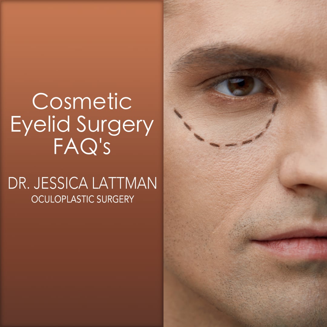 Cosmetic Eyelid Surgery FAQ’s