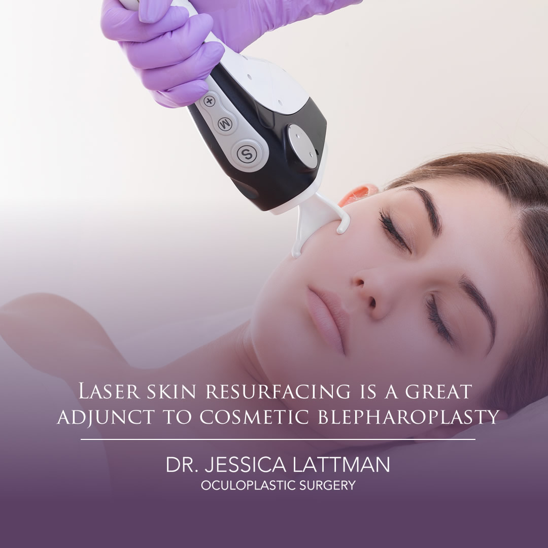 Laser skin resurfacing is a great adjunct to cosmetic blepharoplasty