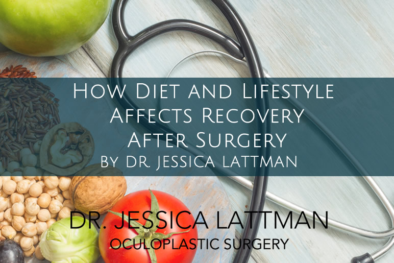 How Diet and Lifestyle Affects Recovery