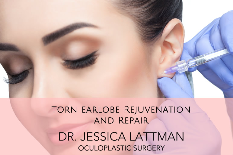 Torn, Stretched, or Sagging Earlobe Repair